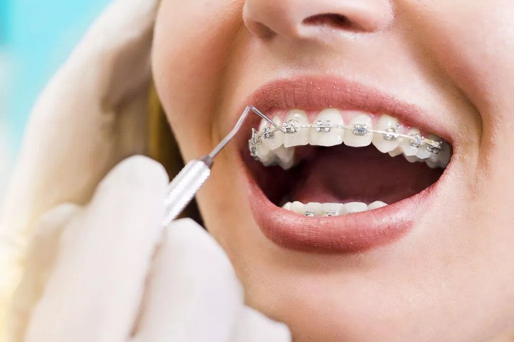 Why More Dentists Are Enrolling In Orthodontic Courses